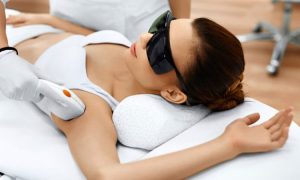 Pengaruh Sinar Matahari pada Laser Hair Removal