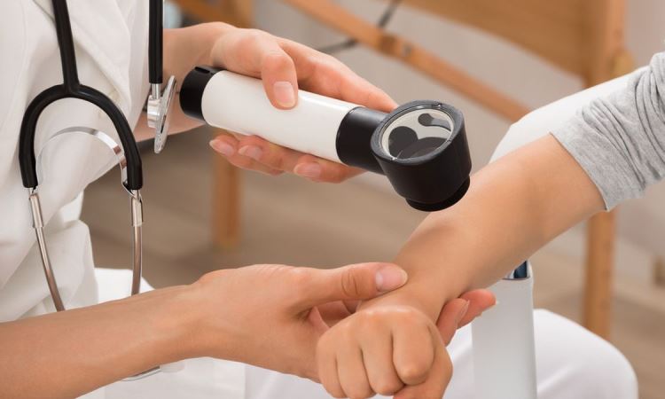 Tips mencegah Kanker Kulit Sejak Dini