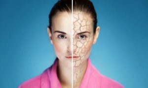 Pengobatan Alami untuk Kulit Kering