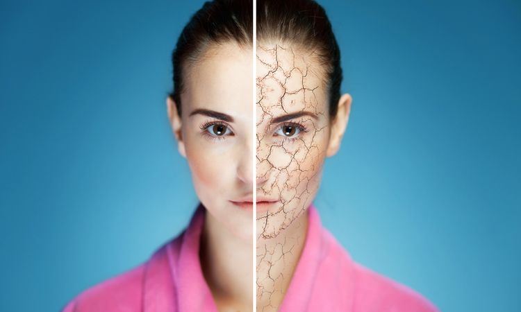 Pengobatan Alami untuk Kulit Kering